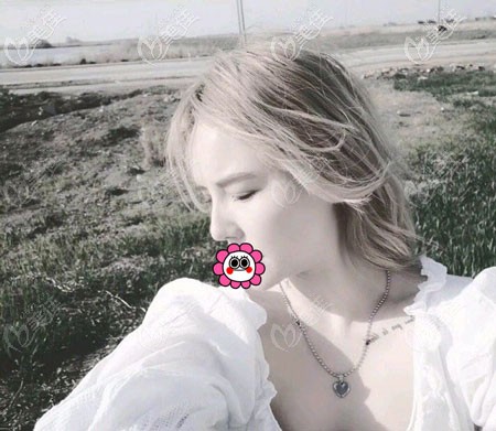 找寧波林勇做鼻子怎么樣呀？想了解更多看價格和案例圖