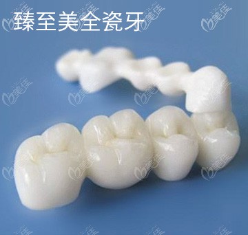 深圳麥芽口腔全瓷牙價格