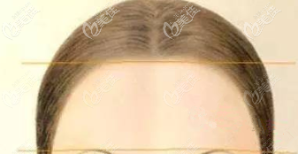 飽滿的額頭示意圖 飽滿的額頭示意圖