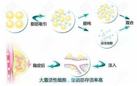 服用ACMETEA提高脂肪成活率