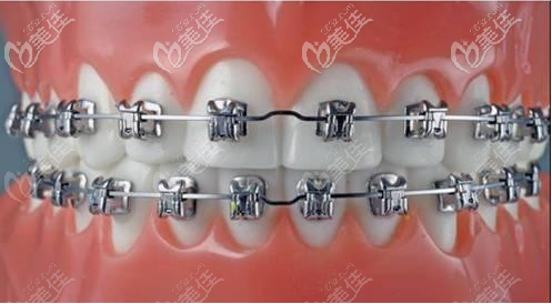 <!--<i data=20240703-sp></i>-->薇琳口腔種植牙技術(shù)正規(guī)