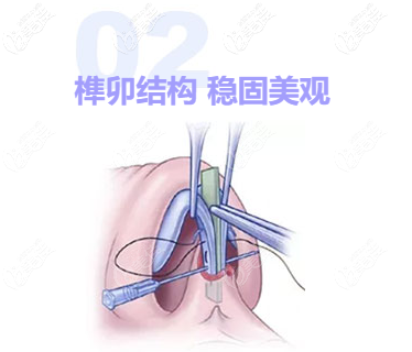 廣州劉冰醫(yī)生技術到底靠不靠譜