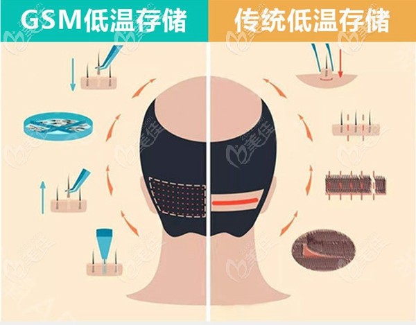 匯美人獨特的毛囊存儲技術