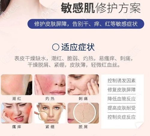 雪夫美塑可以改善敏感肌