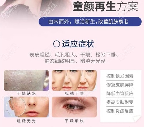 雪夫美塑可以改善細(xì)紋