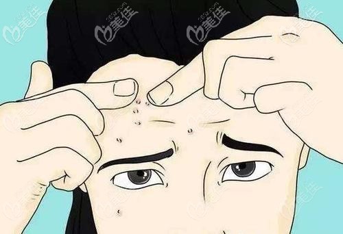 熬夜冒出來(lái)的痘痘