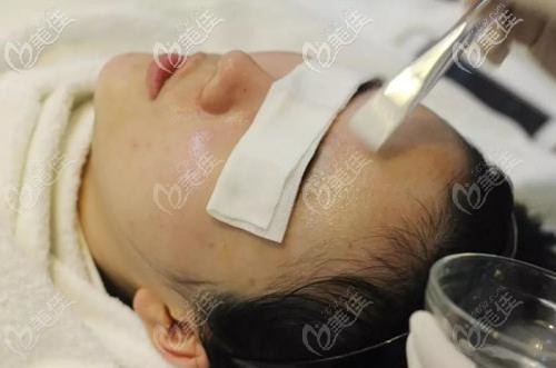 熬夜爆痘可以做果酸換膚