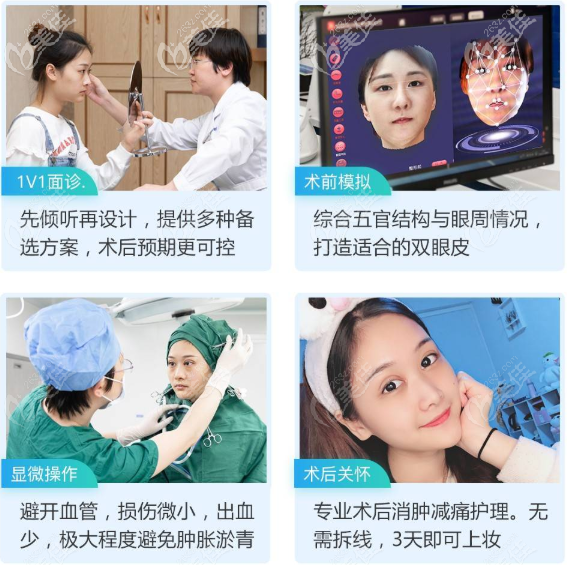 廣州曙光做雙眼皮怎么樣