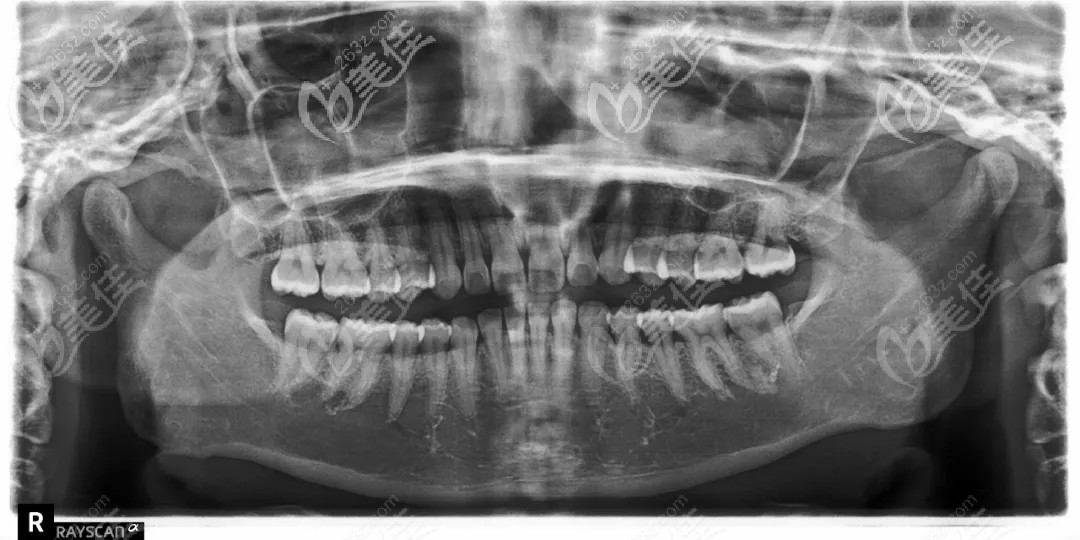 拍片圖示 拍片圖示