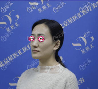 北京如朵醫(yī)療美容門診部孔彥霞術前照片1