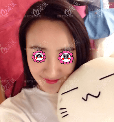 755蜂巢皮秒祛黃褐斑還是較安全的,而且做一次便有一次的效果喲!