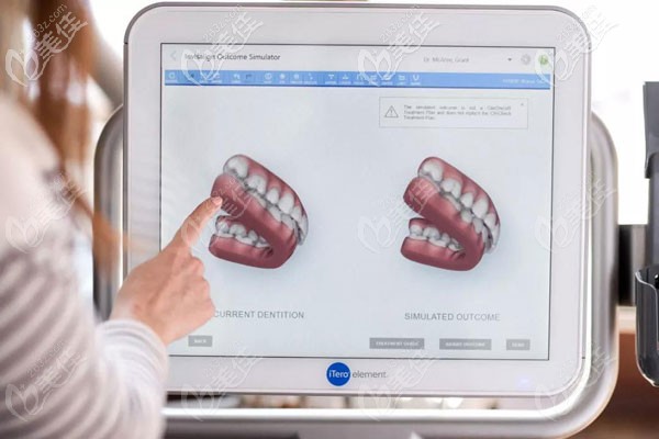 隱適美itero口掃的原理