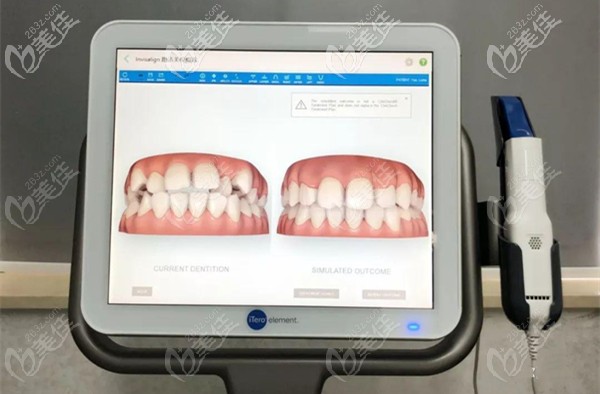 隱適美口腔掃描儀