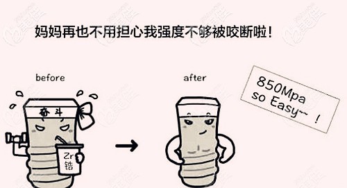 德國(guó)ICX種植體的使用壽命