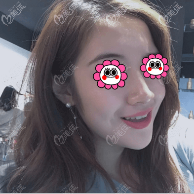 M22光子嫩膚收縮毛孔有一定的效果,也未出現(xiàn)皮膚松弛無(wú)彈性的情況