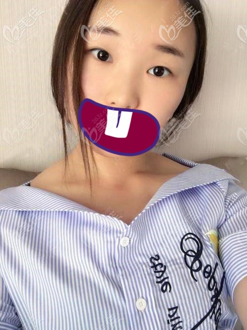 術(shù)前照片 術(shù)前照片