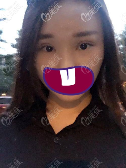 術(shù)后兩個月 術(shù)后兩個月