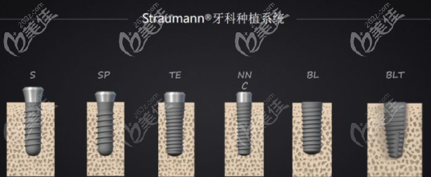士卓曼種植體多種型號(hào)