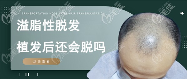 脂溢性脫發(fā)植發(fā)后還會出現(xiàn)掉發(fā)脫發(fā)情況嗎？