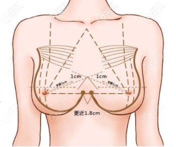 美胸標(biāo)準(zhǔn)是什么？