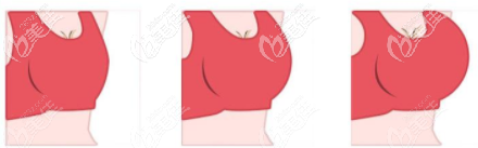 黃金美胸標(biāo)準(zhǔn)線