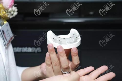 數(shù)字化導板種植牙