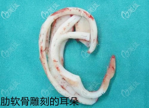 取了耳肋骨的耳朵圖片