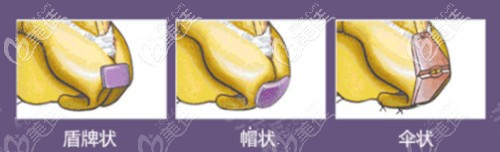 周蔚做鼻子怎么樣