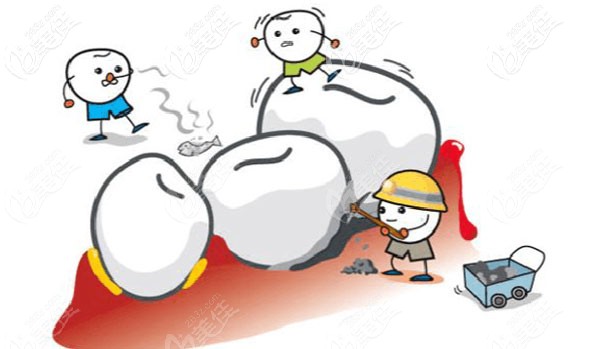 兒童齲齒預防很重要