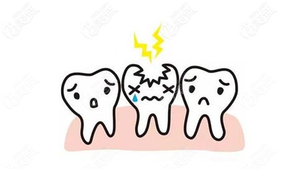 乳牙蛀牙不及時治療還會導致恒牙擁擠不齊哦