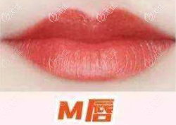 M唇