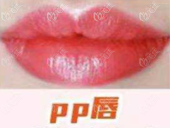 pp唇