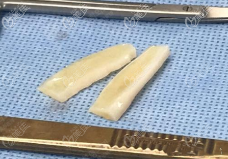 貼發(fā)耳手術(shù)的材料