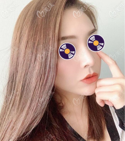 沈紹勇鼻綜合術(shù)后效果