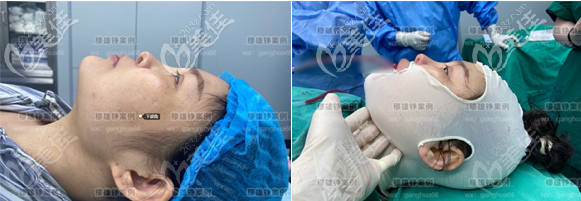 <!--<i data=20240703-sp></i>-->下頜角截骨<span style= <!--<i data=20240703-sp></i>-->下頜角截骨<span style=