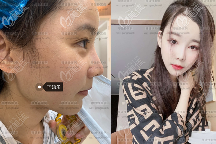 <!--<i data=20240703-sp></i>--><!--<i data=20240703-sp></i>-->醫(yī)生磨骨技術(shù)怎么樣 <!--<i data=20240703-sp></i>--><!--<i data=20240703-sp></i>-->醫(yī)生磨骨技術(shù)怎么樣