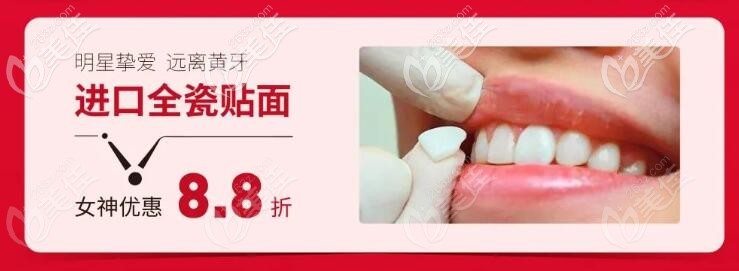 牙齒貼面活動(dòng)價(jià) 牙齒貼面活動(dòng)價(jià)