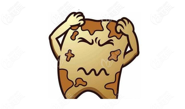 牙黃癥狀 牙黃癥狀