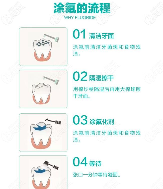 兒童涂氟的方法步驟