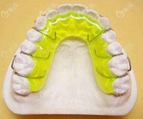 哈雷保持器的優(yōu)缺點