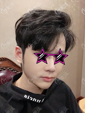 下頜角手術(shù)恢復(fù)過(guò)程圖 下頜角手術(shù)恢復(fù)過(guò)程圖