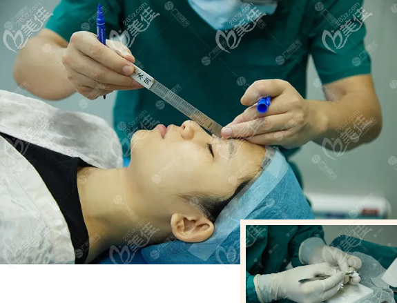 耳軟骨隆鼻單側(cè)好還是雙側(cè)好 耳軟骨隆鼻單側(cè)好還是雙側(cè)好