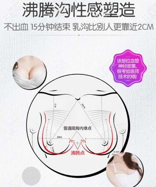 林沸騰醫(yī)生的“沸騰隆胸法”優(yōu)勢(shì) 林沸騰醫(yī)生的“沸騰隆胸法”優(yōu)勢(shì)