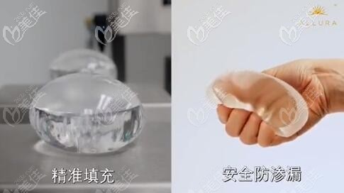 傲諾拉Xtra-星熠系列假體優(yōu)勢(shì) 傲諾拉Xtra-星熠系列假體優(yōu)勢(shì)