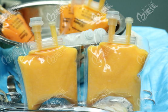 納米脂肪實(shí)物