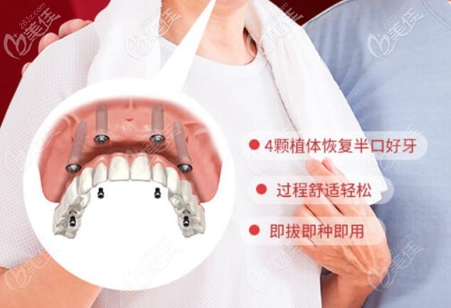 維樂半口allon4種植牙特點(diǎn)介紹 維樂半口allon4種植牙特點(diǎn)介紹