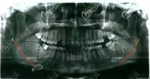 20210311_1615448749923714.png image.png