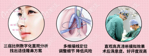 金成植醫(yī)生假體隆鼻的優(yōu)勢(shì) 金成植醫(yī)生假體隆鼻的優(yōu)勢(shì)