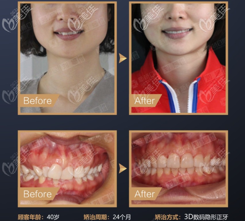 劉珊醫(yī)生的矯正實(shí)例