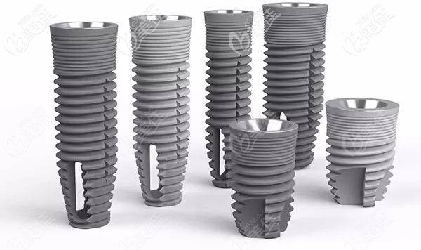 不同種植體的外觀對比